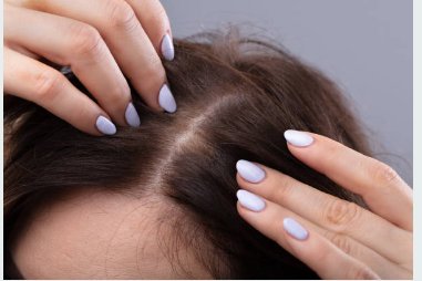 Itchy Scalp- How to Prevent and Treat itching scalp